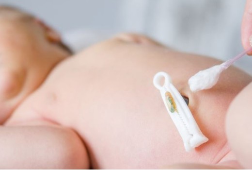 Pravilno čiščenje in nega popka pri novorojenčku