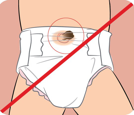 Popkovino ne sme biti pokrita s plenico Popkovino ne sme biti pokrita s plenico