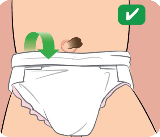 Popek naj bo izven plenice Popek naj bo izven plenice