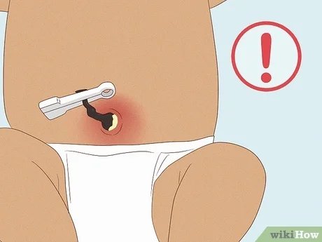 Popek se ne sme vneti